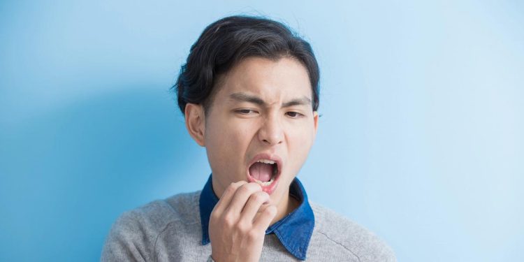 Kenali Sariawan: Penyebab, Jenis dan Cara Mencegah Sariawan