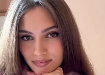 Akhir Tragis Mantan Miss Universe Rusia Meninggal Setelah Ditabrak Rusa