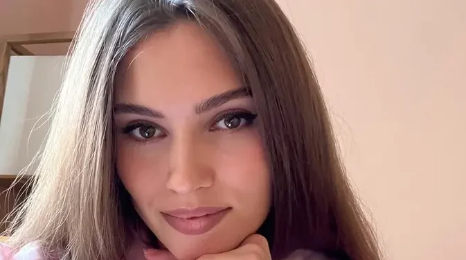 Akhir Tragis Mantan Miss Universe Rusia Meninggal Setelah Ditabrak Rusa