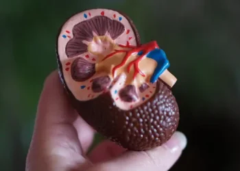 Penanganan Batu Ginjal Tanpa Perlu Operasi Terbuka