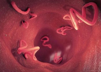 Balita di Sukabumi Meninggal Diduga Tubuhnya Terinfeksi Cacing