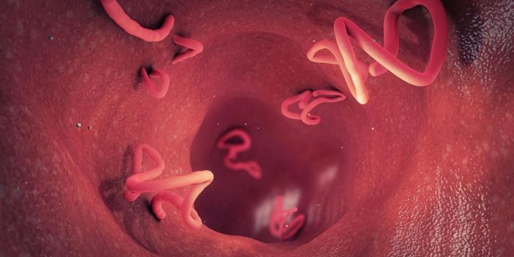 Balita di Sukabumi Meninggal Diduga Tubuhnya Terinfeksi Cacing