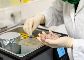 Apakah Donor Organ Diperbolehkan dalam Perspektif Islam?