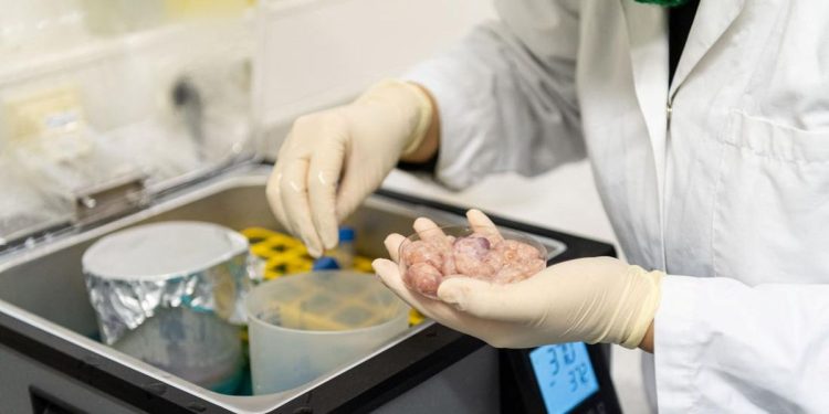 Apakah Donor Organ Diperbolehkan dalam Perspektif Islam?