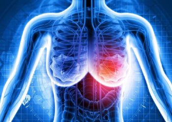 7 Penyebab Bercak Merah di Kulit Payudara Tanpa Gatal