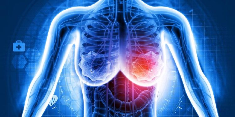 7 Penyebab Bercak Merah di Kulit Payudara Tanpa Gatal