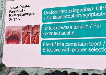 Mendengkur Bukan Pertanda Tidur Nyenyak Menurut Dokter