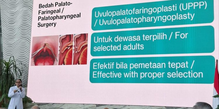 Mendengkur Bukan Pertanda Tidur Nyenyak Menurut Dokter