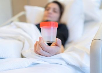 Apakah Batu Ginjal Bisa Keluar Sendiri Melalui Urine? Berikut Penjelasannya