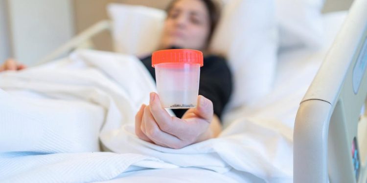 Apakah Batu Ginjal Bisa Keluar Sendiri Melalui Urine? Berikut Penjelasannya