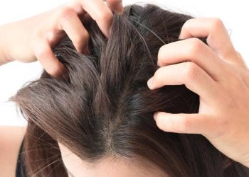 Penyebab Jerawat di Kulit Kepala dan Solusi untuk Mengatasinya