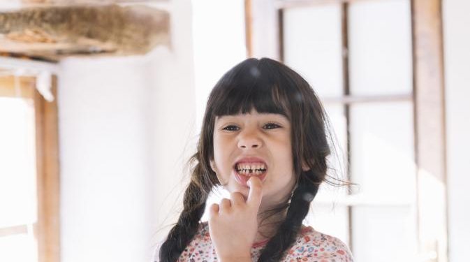 Masalah Gigi Anak Sering Diabaikan Baru Periksa Dokter Saat Sudah Parah