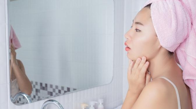 Jerawat Hormonal Penyebab dan Cara Mengatasi Tanpa Bekas