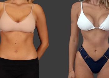 Fenomena Tubuh Ozempic, Wanita Buang Tulang Rusuk demi Pinggang Ramping