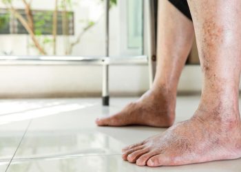 Gatal karena Diabetes, Ini Bagian Tubuh yang Paling Umum Terasa